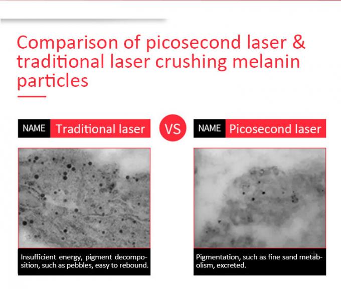 leistungsfähiger Laser der Picosekunden-900ps für Tätowierungs-Abbau-hohen homogenen Stellen-Modus 1
