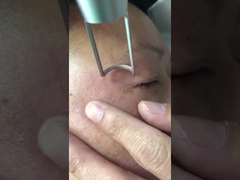 Laser-Maschine 1064nm 532nm Q der Picosekunden-450ps schaltete Nd Yag