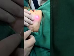 Professionelle 1470nm Diode Laser Fettverringerung Maschine Sichtbare Ergebnisse in 2-3 Sitzungen