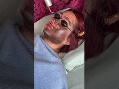 Gesichtslift 585nm 650nm Picosecond Laser Gerät 500ps 750ps 2000ps